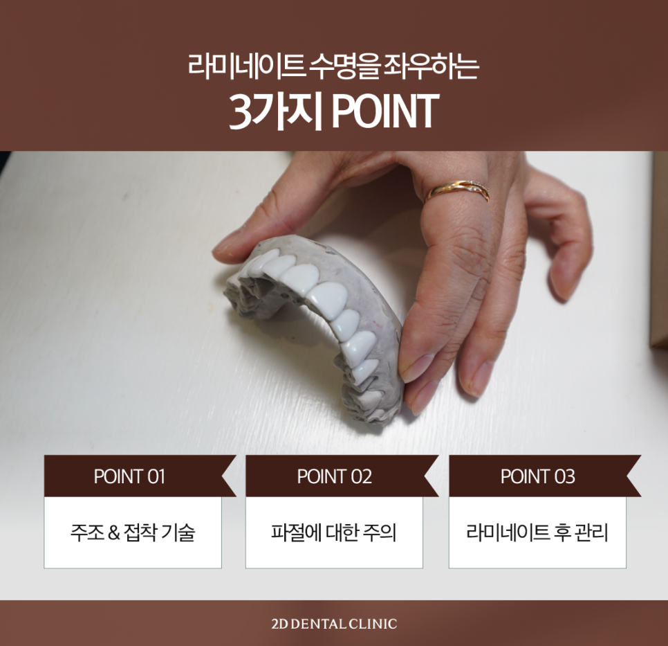 라미네이트제거 치아시림 튼튼한 상태로 유지할 수 있도록 관련 이미지 4