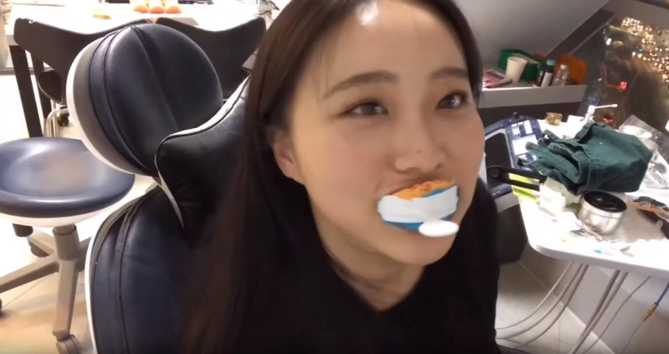 무삭제 라미네이트 쎄라필름, 정말 무삭제? [쎄라필름(TheraFilm)후기_유튜버 Soyeon_pp님] by. 투디치과(2D치과) 관련 이미지 18