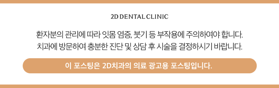 토끼이빨라미네이트 앞니심미치료로 자신 있게 웃어보세요! 관련 이미지 12