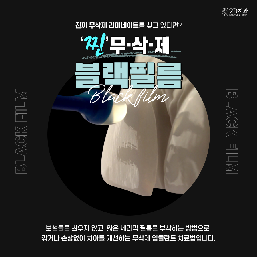 진짜 관련 이미지 1