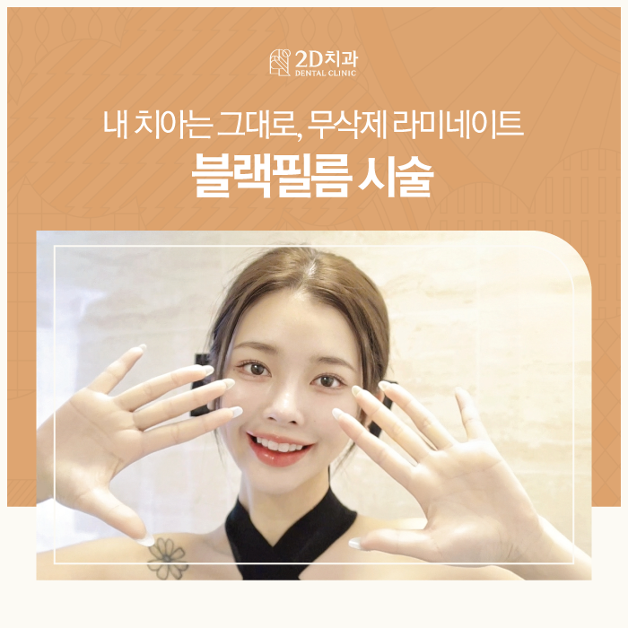 내 치아는 그대로! 인천무삭제라미네이트 관련 이미지 1
