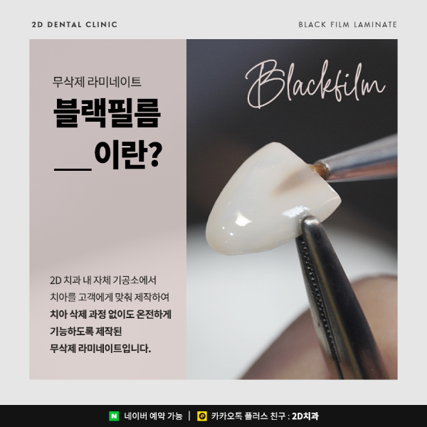 무삭제 라미네이트 <블랙필름> 이 궁금하다면? 관련 이미지 2