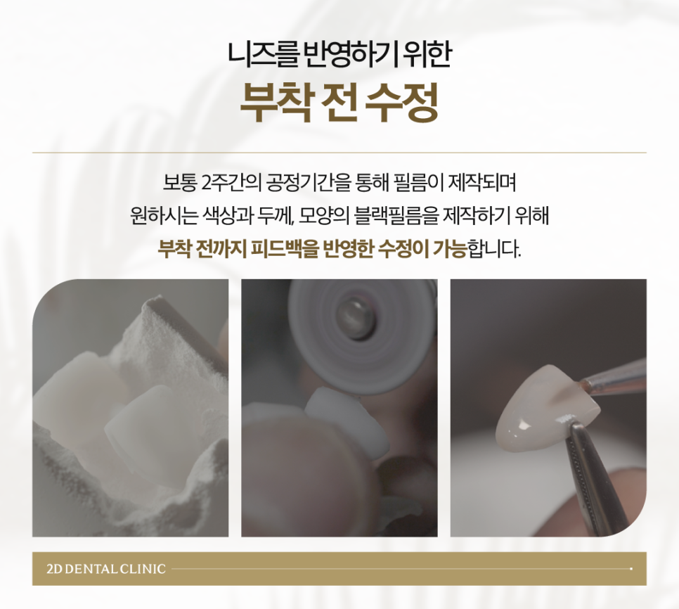 인천무삭제라미네이트 치아착색 화사한 이로 깨끗한 인상을 주고 싶을 때 관련 이미지 6