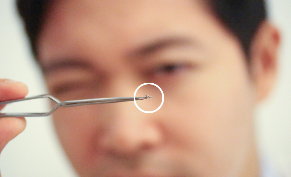 2D(투디)치과!치아교정!클리피씨교정,순측 교정?설측교정? 관련 이미지 6