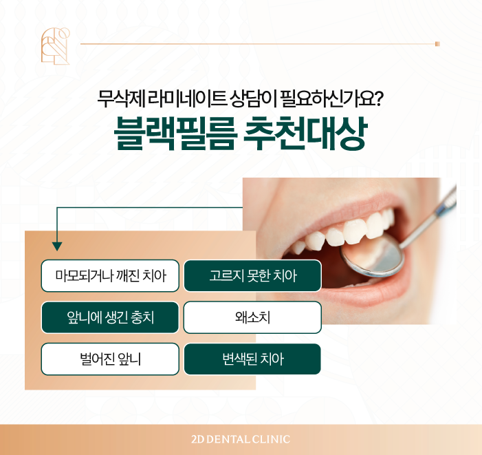 무삭제라미네이트 앞니성형 꼼꼼하게 진행하려면 관련 이미지 3