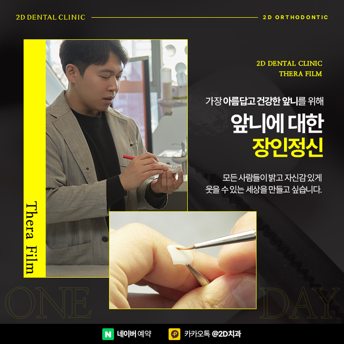 이빨 벌어짐 개선 앞니부분교정가격 비교하고 강남역 부분교정 관련 이미지 3