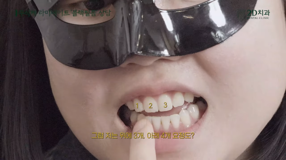 [블랙필름 상담받고 왔어요] #3 앞니가 깨졌어요 관련 이미지 30