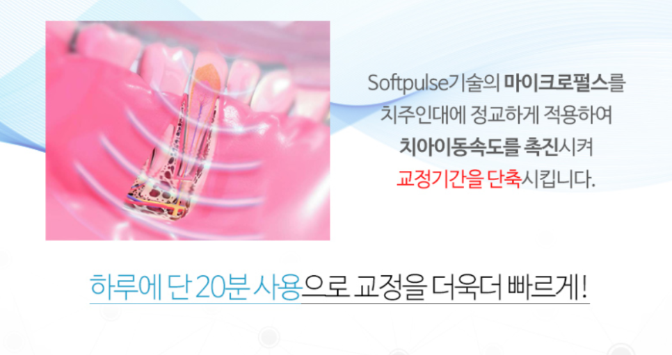 앞니 부분교정 기간 얼마나 걸릴까? 강남 투디치과 관련 이미지 9