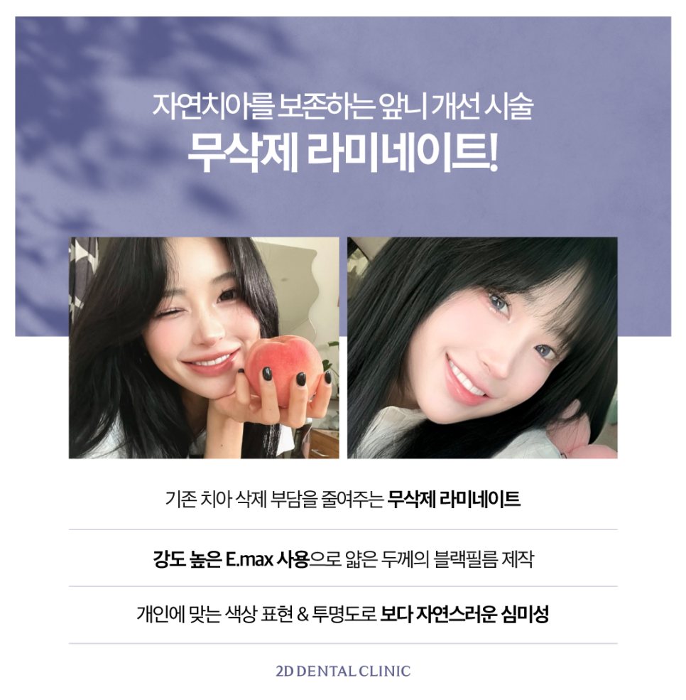 최준희라미네이트 치아착색 블랙필름으로 환해진 얼굴! 관련 이미지 3