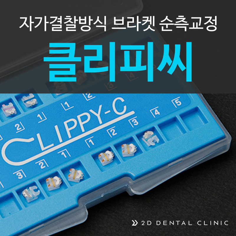 [투디(2D)치과] 클리피씨 교정에 대해 알아보자! 관련 이미지 2