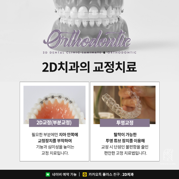 "치아 콤플렉스 극복" 치아 교정과 라미네이트중 뭐가 더 좋을까? 관련 이미지 5