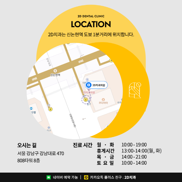 앞니깨짐, 치아변색 앞니고민 해결사! <세라필름 &middot; 블랙필름> 관련 이미지 8