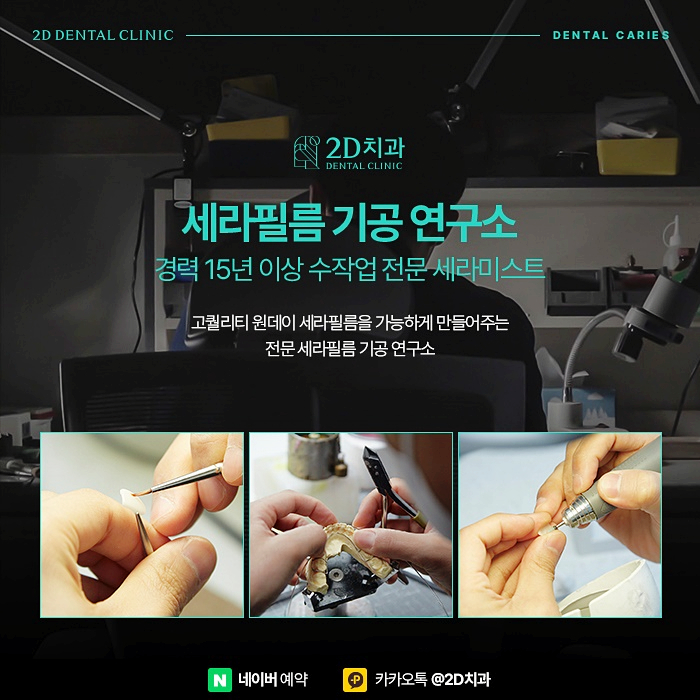 충치치료비용 아끼는 방법, 신논현 충치치료 잘하는 곳 관련 이미지 5