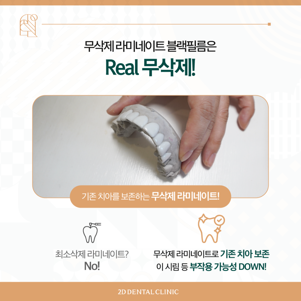 라미네이트 무삭제블랙필름 치아변색 고민, 해결은? 관련 이미지 4