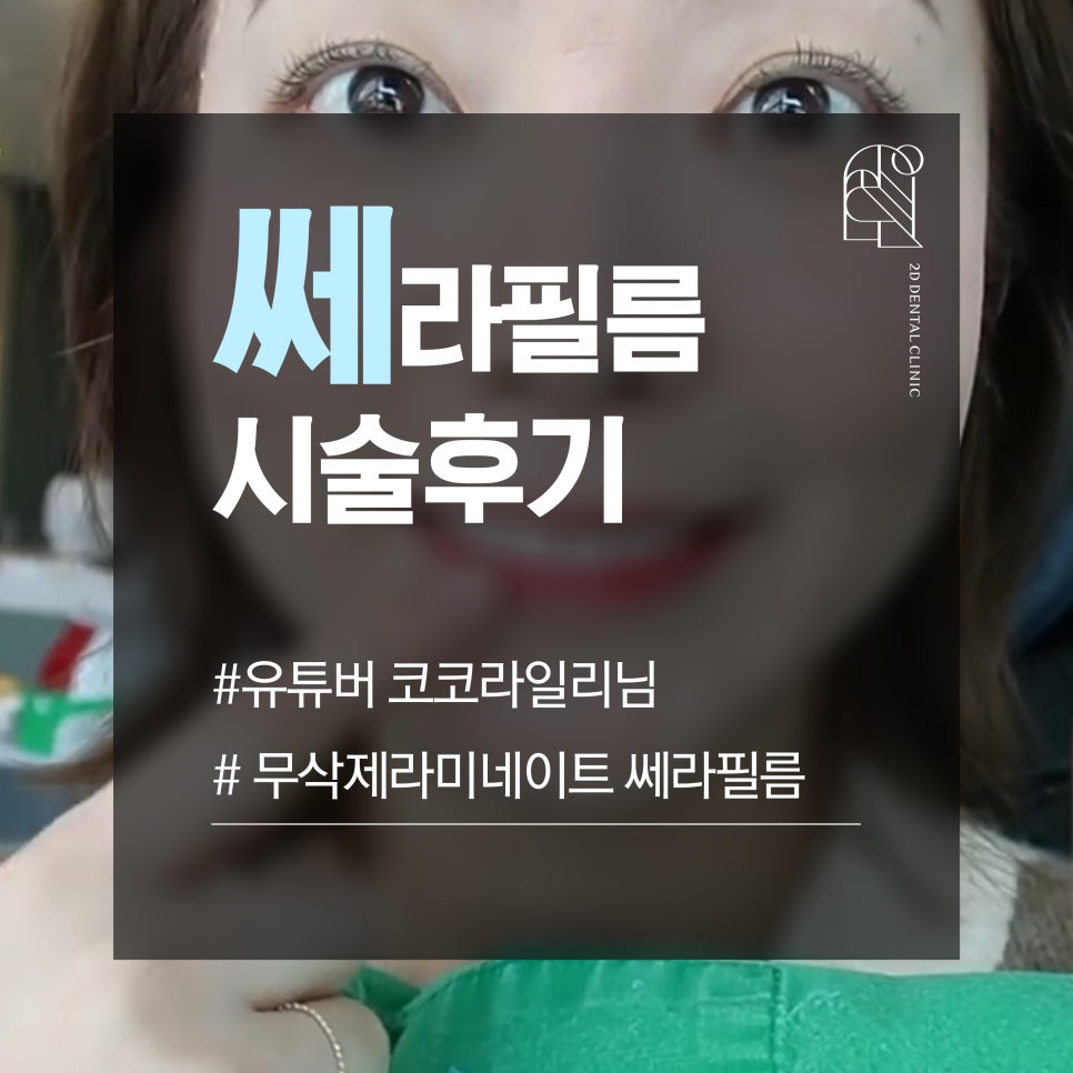 무삭제 라미네이트, 쎄라필름(TheraFilm)후기_유튜버Coco Riley님 by.2D치과(투디치과) 관련 이미지 1