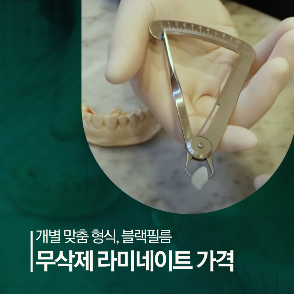 압구정치과 치아성형비용 무삭제 블랙필름 가격과 장점 관련 이미지 1