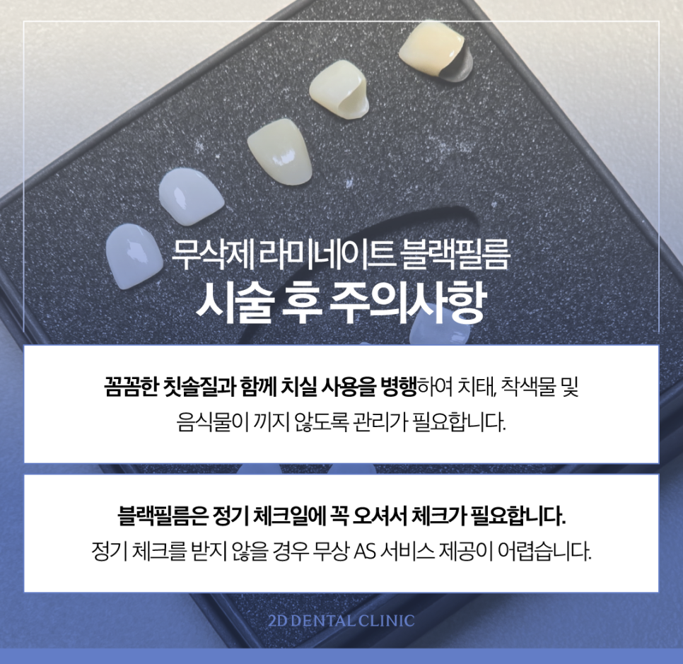 무삭제라미네이트후기 심미보철 나에게 적합한 방식을 찾아보세요 관련 이미지 8