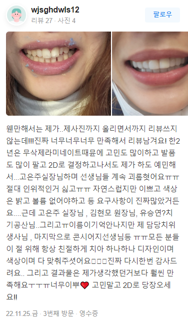 무삭제 라미네이트 비용 알아보기 ! 관련 이미지 7