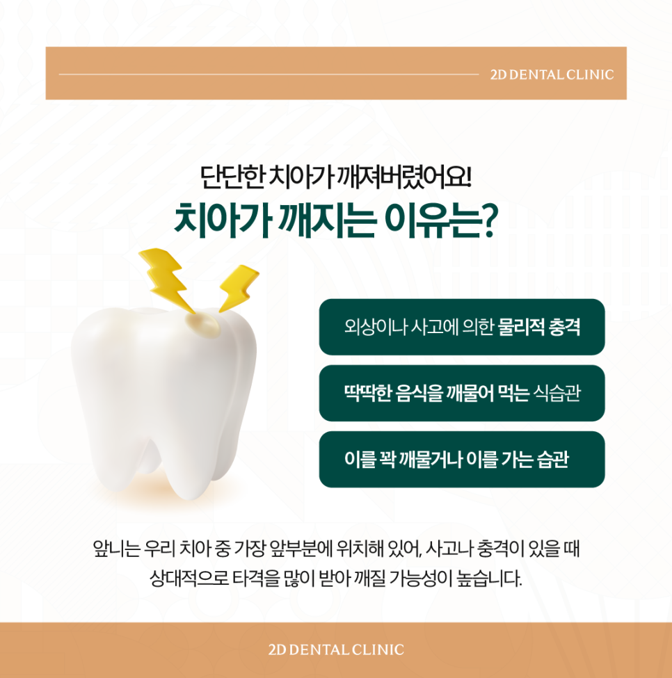 무삭제라미네이트후기 치아살짝깨짐 그대로 두어도 될까요? 관련 이미지 3