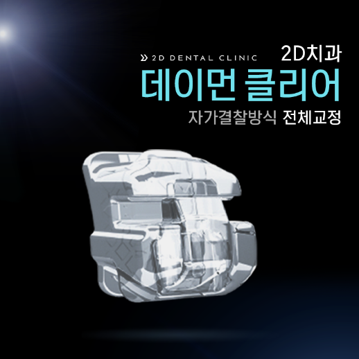 [투디(2D)치과] 데이먼 클리어 교정에 대해 알아보자! 관련 이미지 2