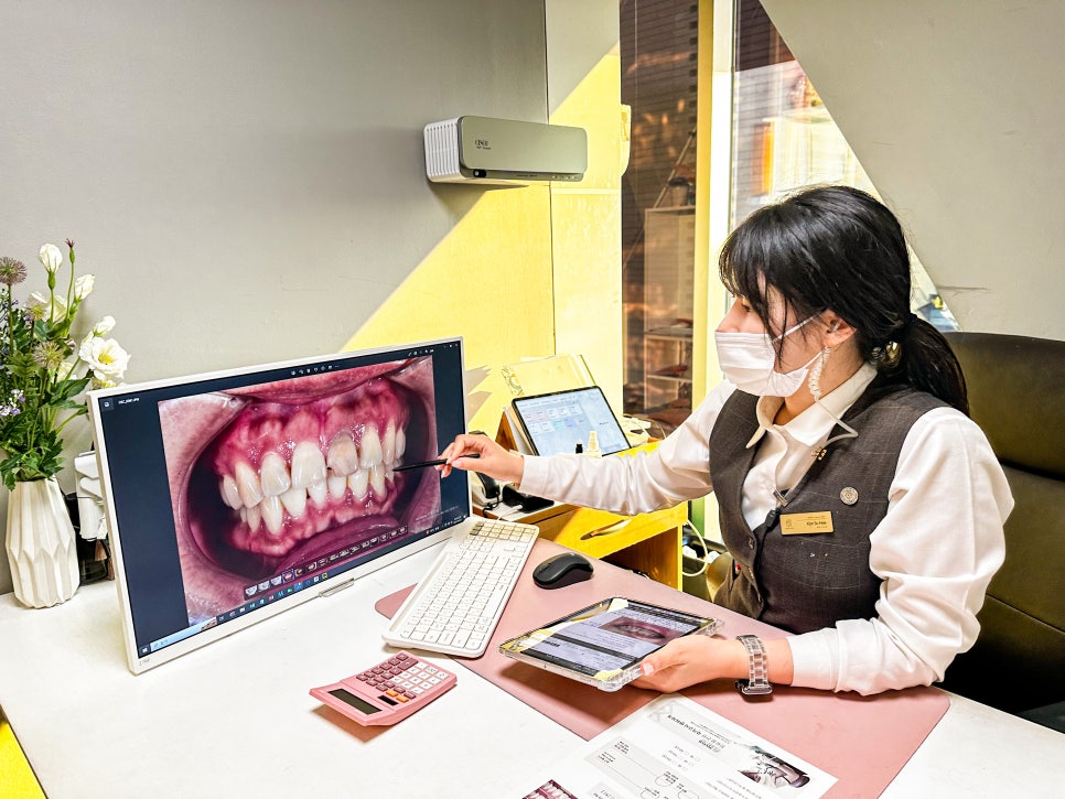 연예인 라미네이트 치아삭제없는 무삭제라미네이트 블랙필름 관련 이미지 6