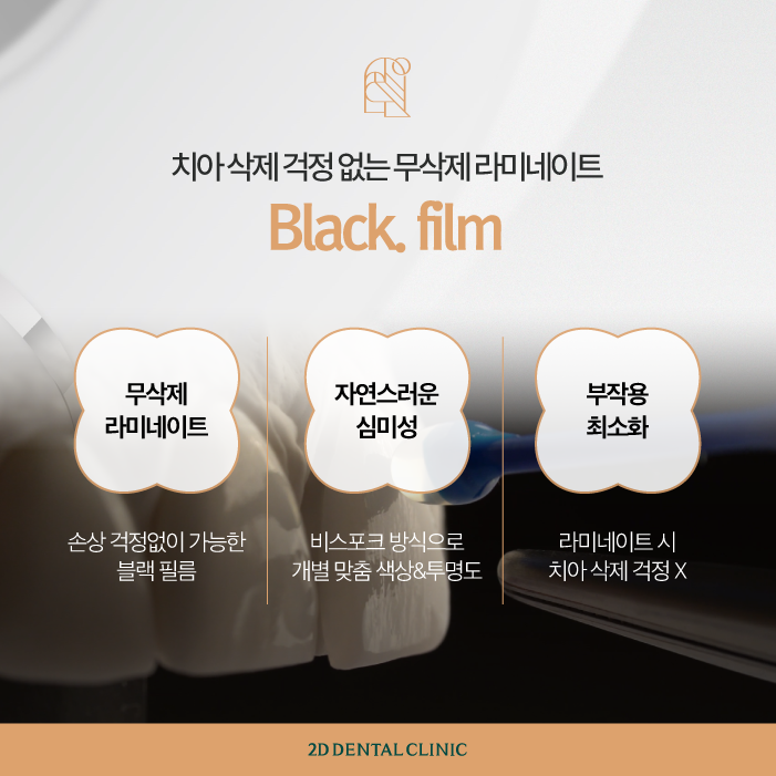 무삭제라미네이트 후기 꼼꼼하게 확인하자! 관련 이미지 3