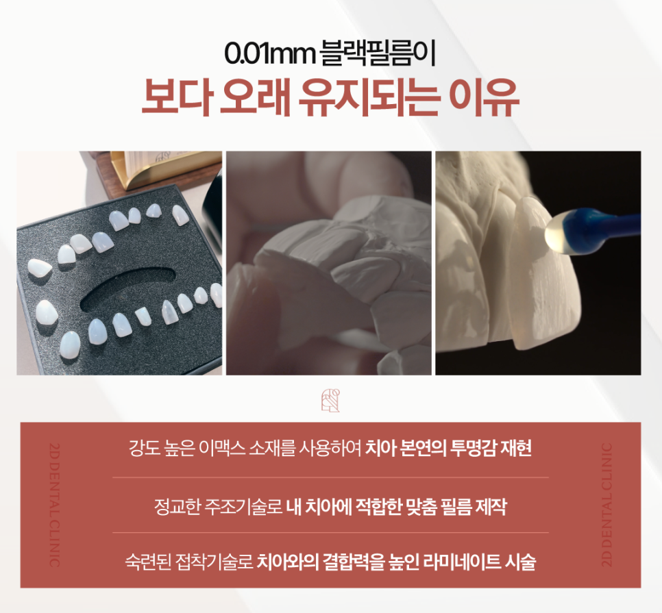 창원무삭제라미네이트 치아균열 이에 생긴 금, 어떻게 해야 할까? 관련 이미지 5