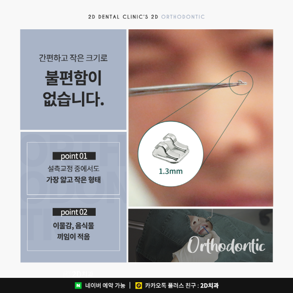 앞니가 고민이라면? 답은 <2D교정> 관련 이미지 5