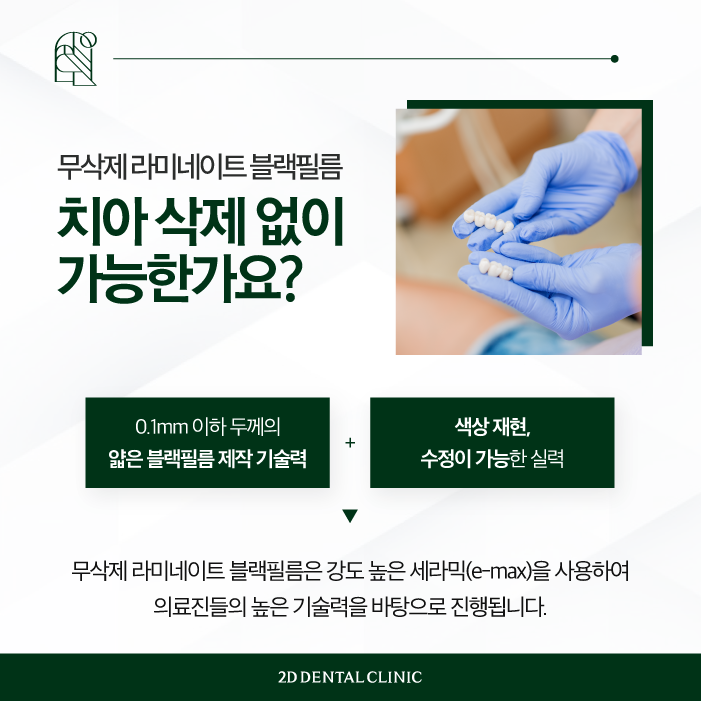 자연스러운 앞니라미네이트를 위한 방법 관련 이미지 3