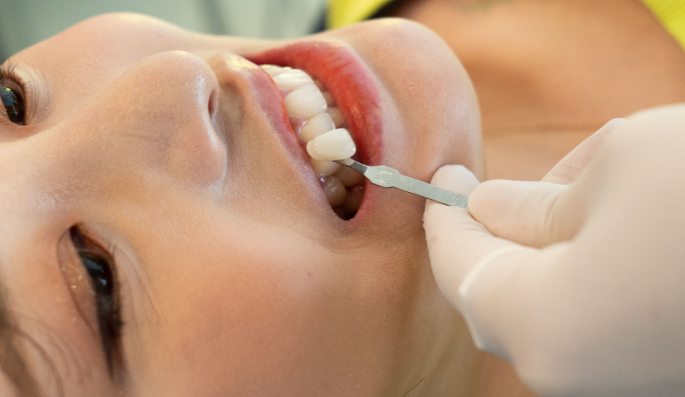 무삭제 라미네이트 교정 고민중이라면? 관련 이미지 2