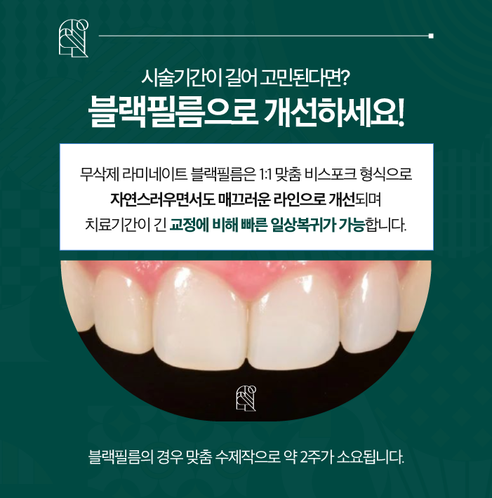 울퉁불퉁한 치아라인을 매끄럽게 무삭제라미네이트 블랙필름 관련 이미지 5