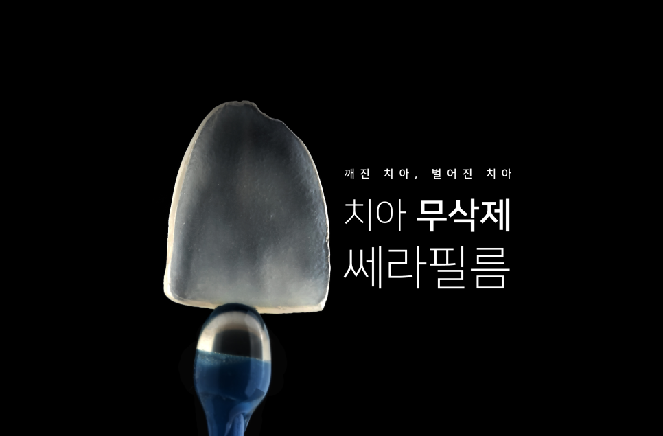 깨진 치아, 벌어진 치아 전부 관련 이미지 1