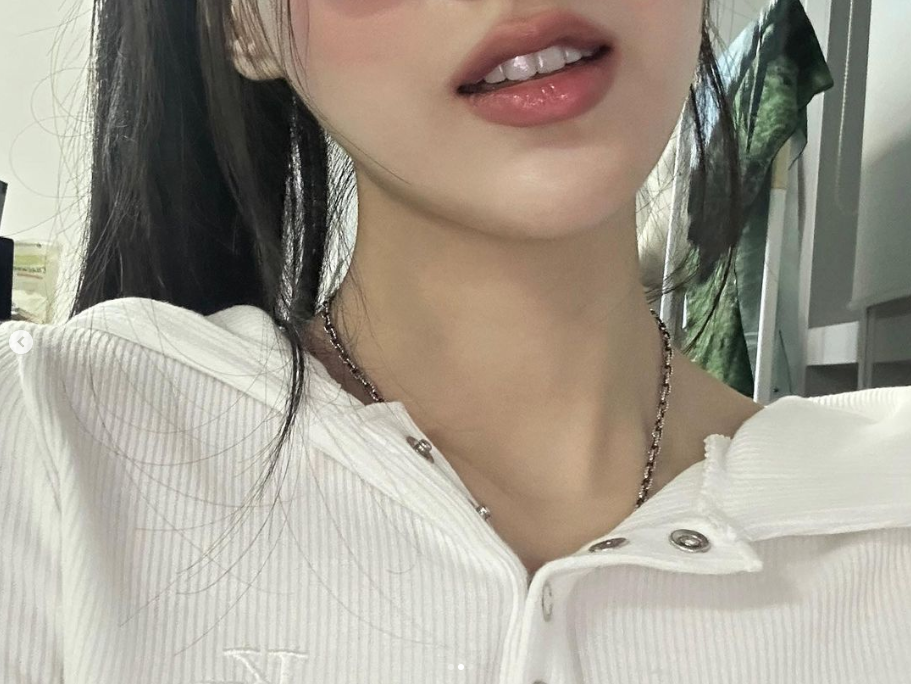 치아블랙필름 무삭제 라미네이트 시술시간, 유지기간, 비용 관련 이미지 2