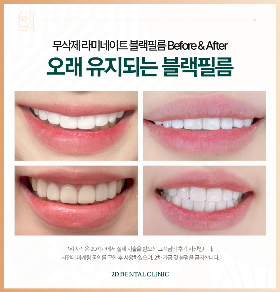 창원무삭제라미네이트 오랫동안 사용할 수 있는 블랙필름 관련 이미지 8