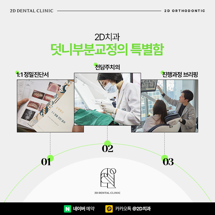 덧니부분교정 2D교정으로 해결, 강남 설측교정 관련 이미지 6