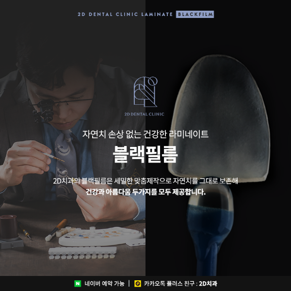 치아 삭제 없는 앞니 무삭제 라미네이트 <블랙필름> 관련 이미지 3