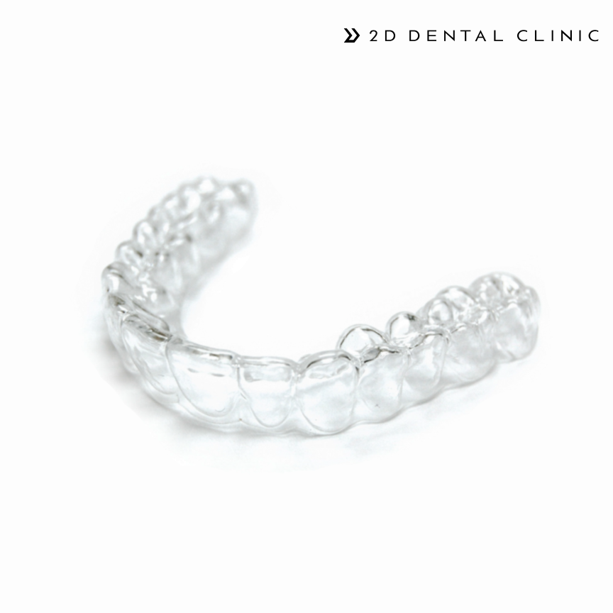 토끼이빨, 앞니 부분교정으로 단기간에! 강남 투디치과 관련 이미지 7