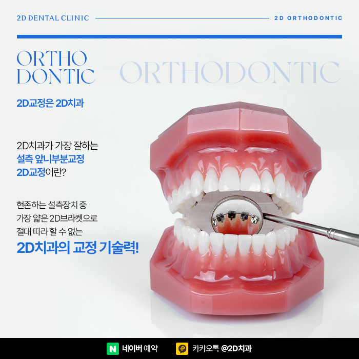 앞니부분교정 보이지 않게 빠르게 진행하는 방법, 2D부분교정 관련 이미지 4