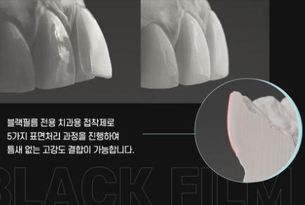 무삭제라미네이트부작용 블랙필름과 비교 관련 이미지 5
