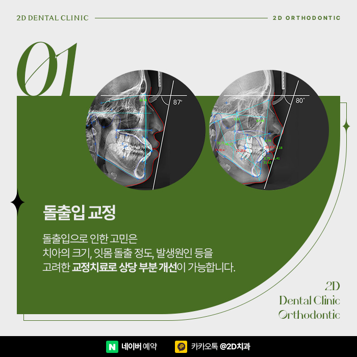 치아교정으로 얼굴형이 바뀔까? 돌출입, 무턱 교정치과 관련 이미지 6