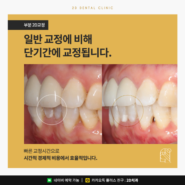 필요한 부분만 부담 없이 빠르게! <부분 2D교정> 관련 이미지 6