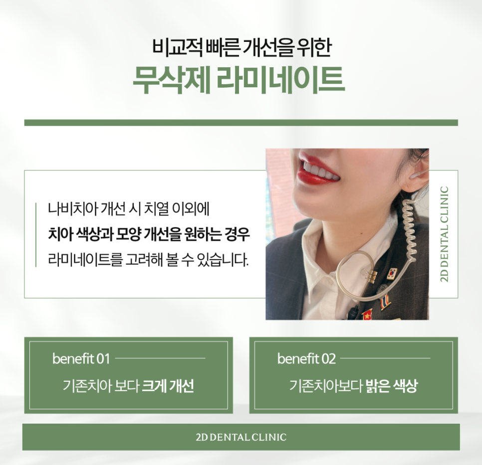 전주무삭제라미네이트 나비치아 안으로 쏠린 앞니도 반듯하게 관련 이미지 4