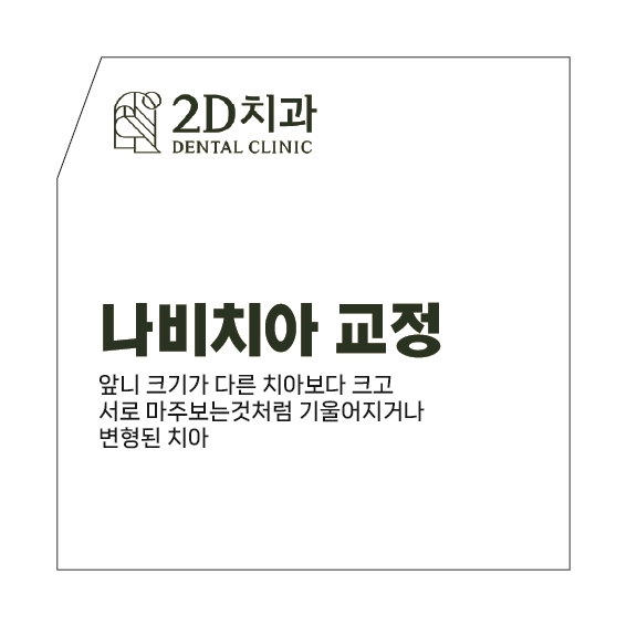 라미네이트교정 나비치아 토끼앞니 블랙필름 관련 이미지 3