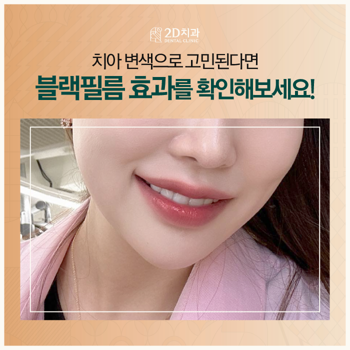무삭제라미네이트비용 2D치과 변색치아를 하얗게! 관련 이미지 1