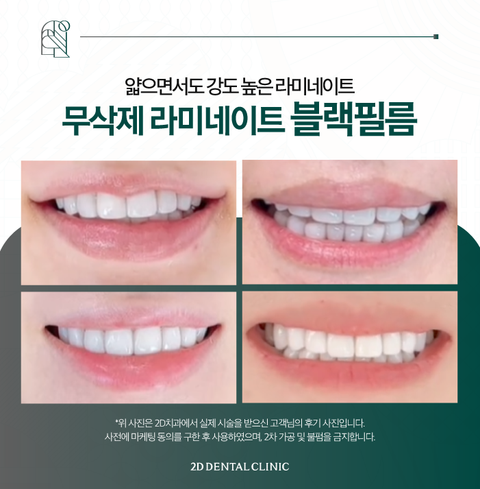 얇고 튼튼한 강남무삭제라미네이트 블랙필름 관련 이미지 8