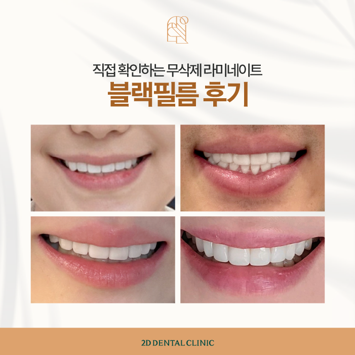 무삭제라미네이트 후기 꼼꼼하게 확인하자! 관련 이미지 6