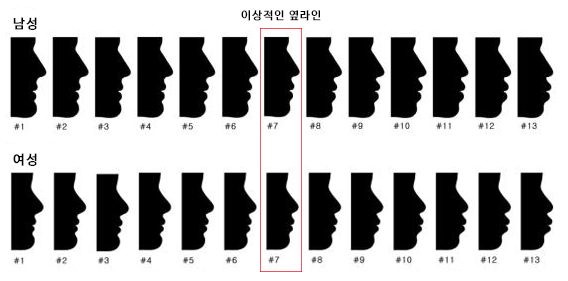 돌출입 유형 및 증상, 치과 내원 전 자가진단! 관련 이미지 5