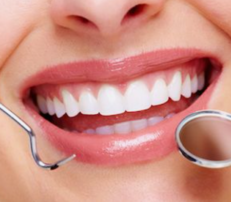 치아성형 잇몸성형 치아삭제 없는 무삭제라미네이트 블랙필름 관련 이미지 2