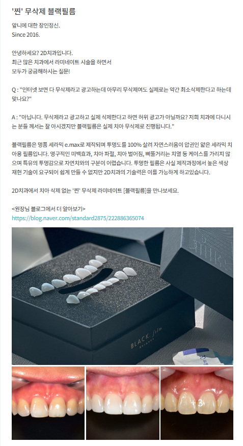 2D치과 치아정보전달을 위한 SNS채널운영 김현모대표원장님 개인유튜브 닥터모모 관련 이미지 9