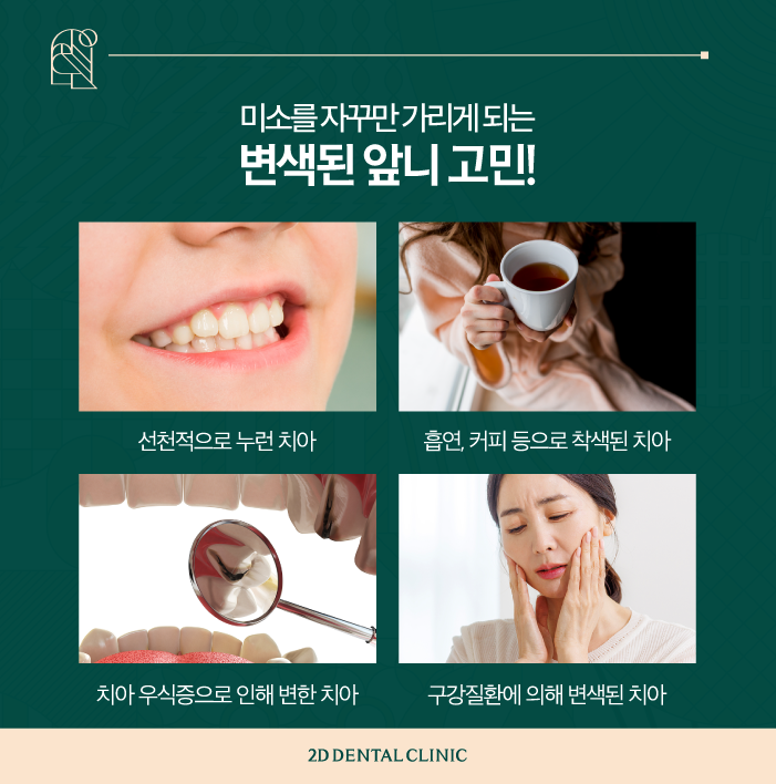 부산무삭제라미네이트 멀리서도 찾아주시는 블랙필름 관련 이미지 3